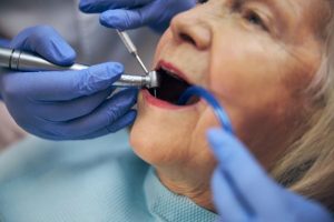 Aussies told not to delay dental work