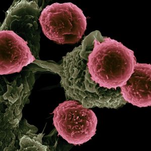 World-leading cancer treatment centre opens its doors